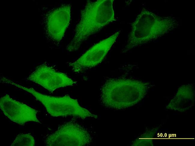 ATP6V1A Antibody in Immunocytochemistry (ICC/IF)