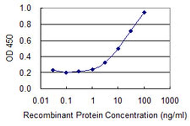 ATP6V1B1 Antibody in ELISA (ELISA)