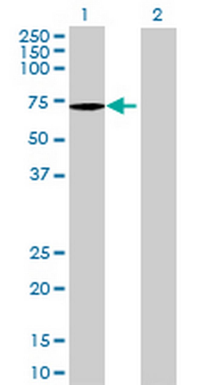 ATP6AP1 Antibody in Western Blot (WB)