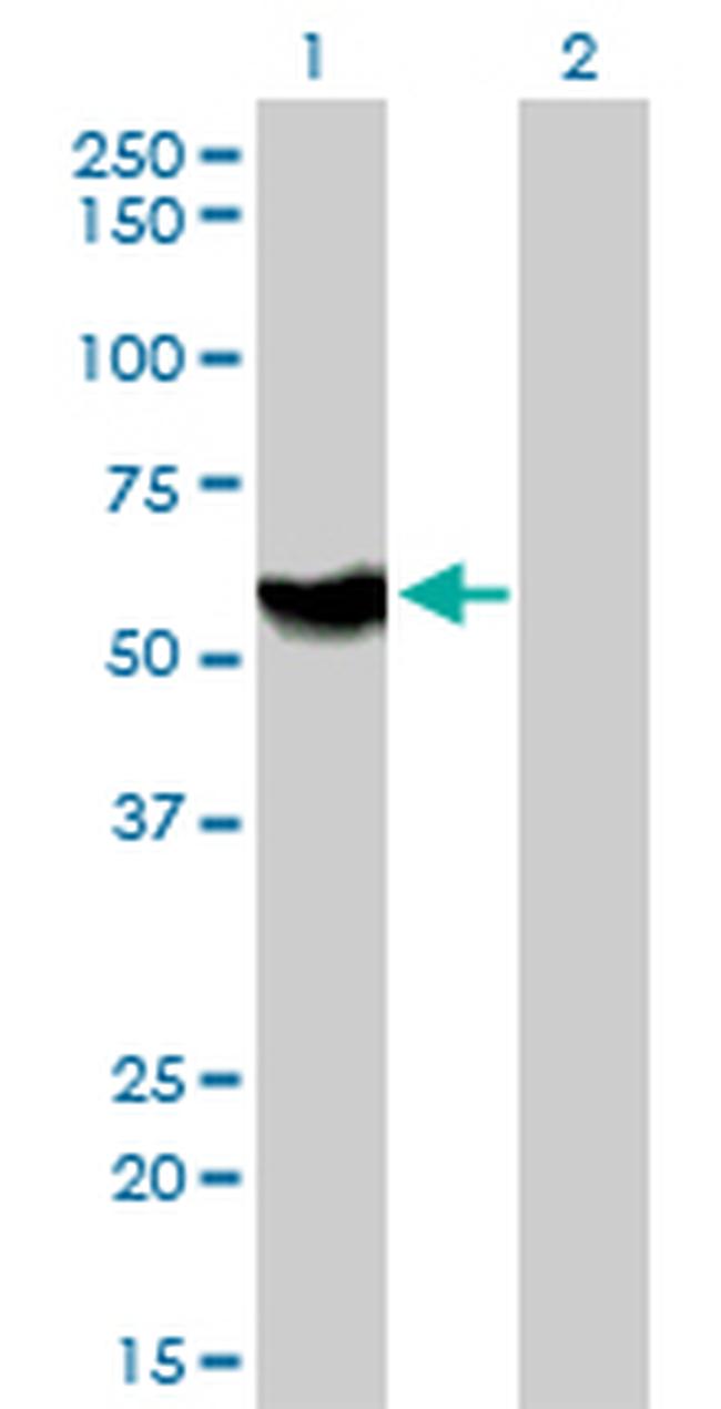 ATP6AP1 Antibody in Western Blot (WB)