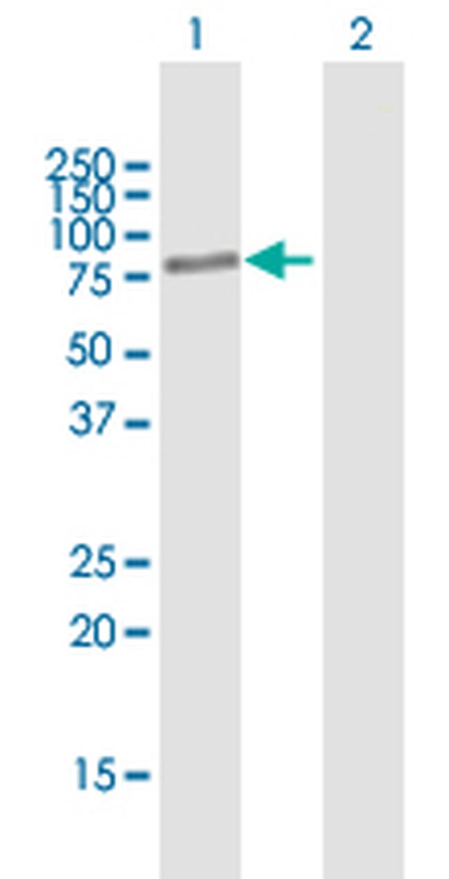 BBS2 Antibody in Western Blot (WB)