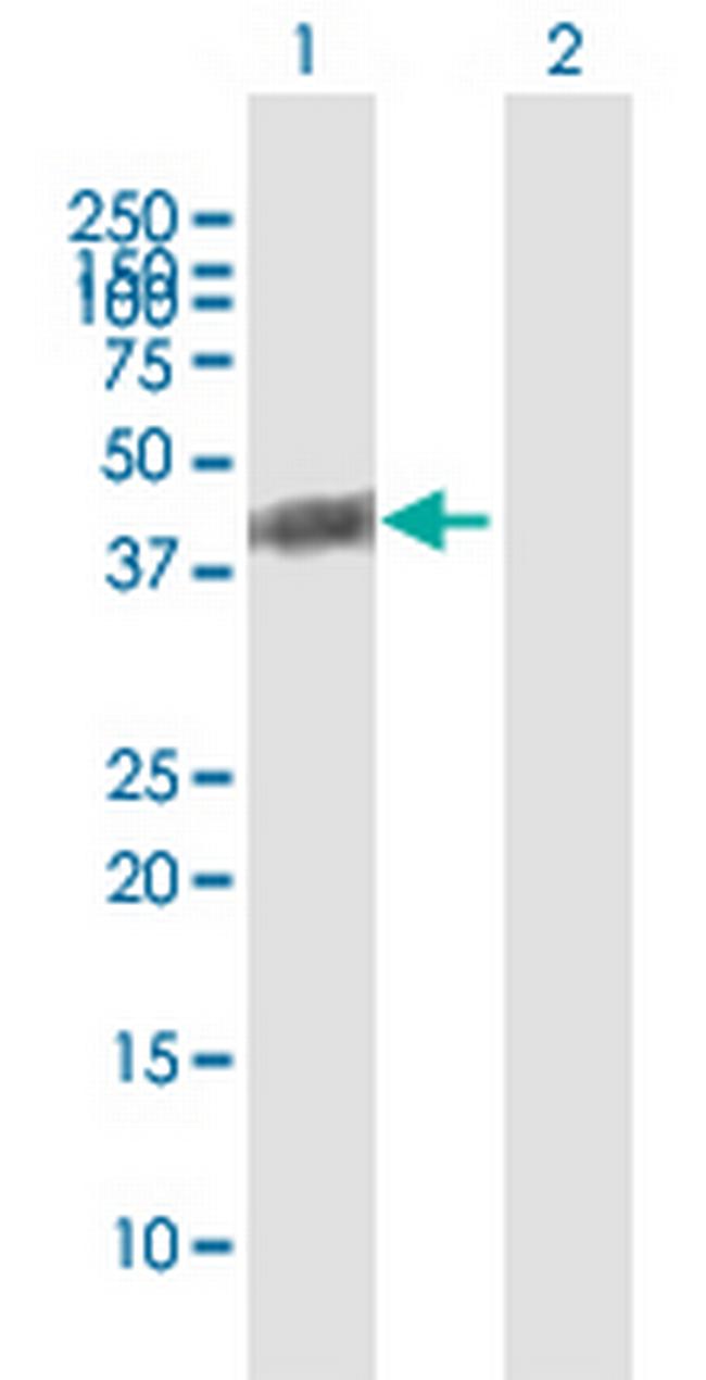 BCKDHA Antibody in Western Blot (WB)