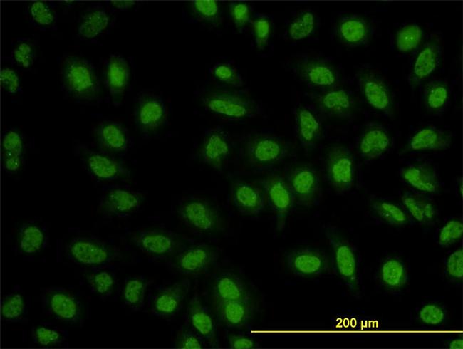 BCL9 Antibody in Immunocytochemistry (ICC/IF)