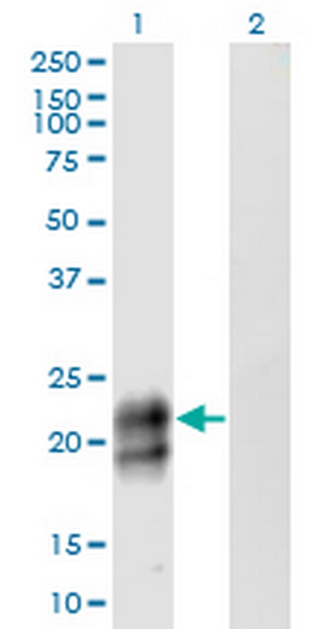 TNFRSF17 Antibody in Western Blot (WB)