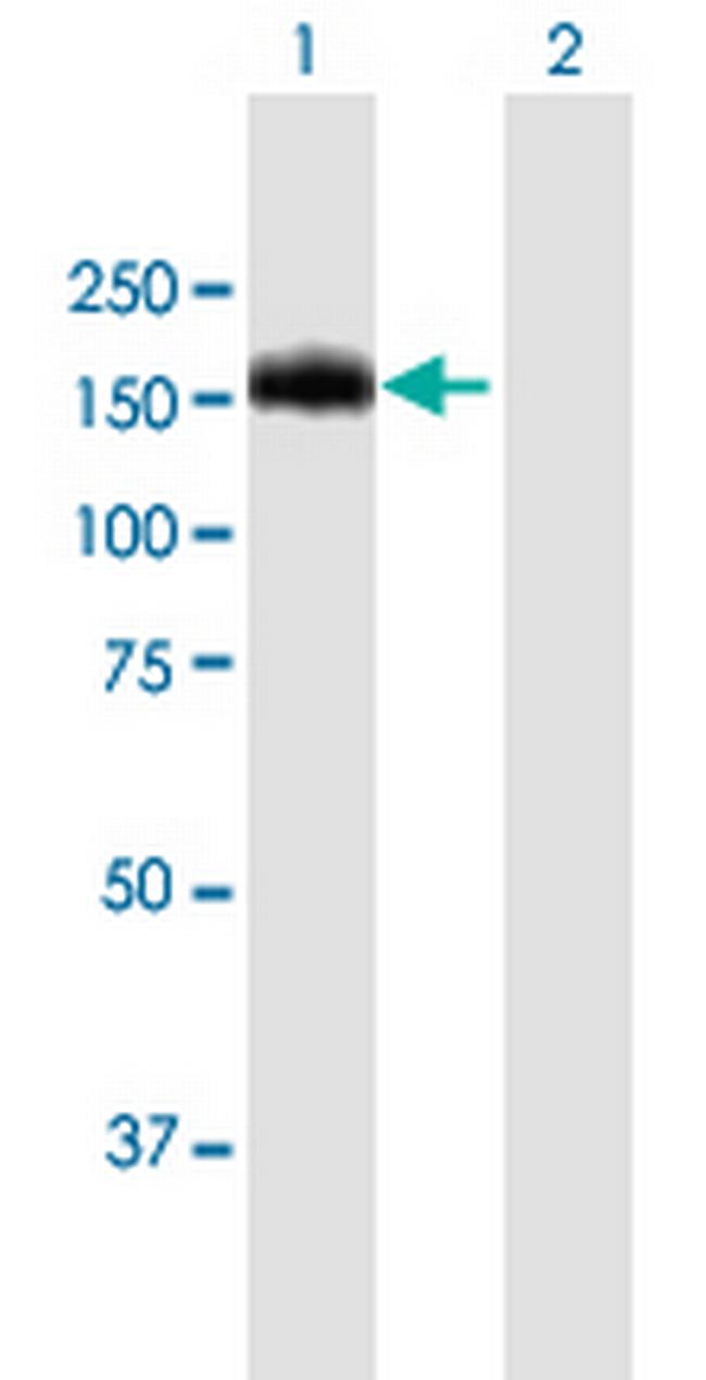 BCR Antibody in Western Blot (WB)