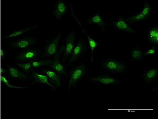 BCR Antibody in Immunocytochemistry (ICC/IF)