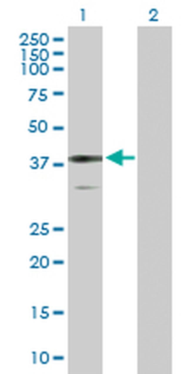 BDH1 Antibody in Western Blot (WB)