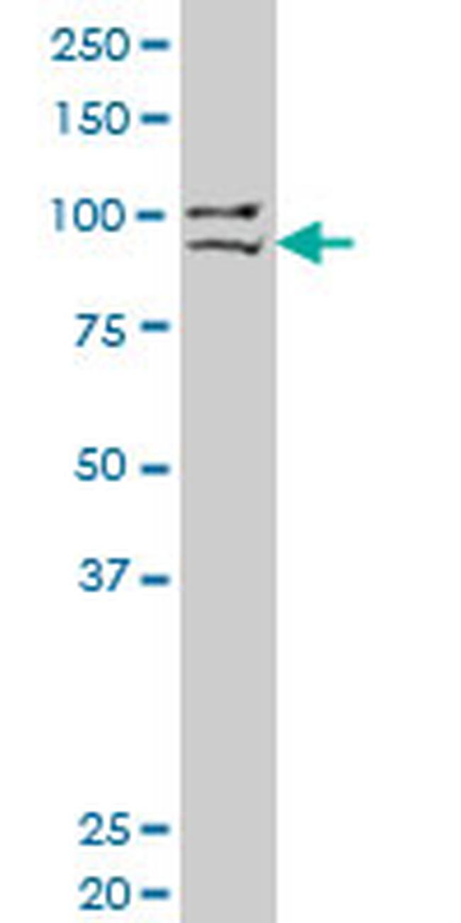 PRDM1 Antibody in Western Blot (WB)