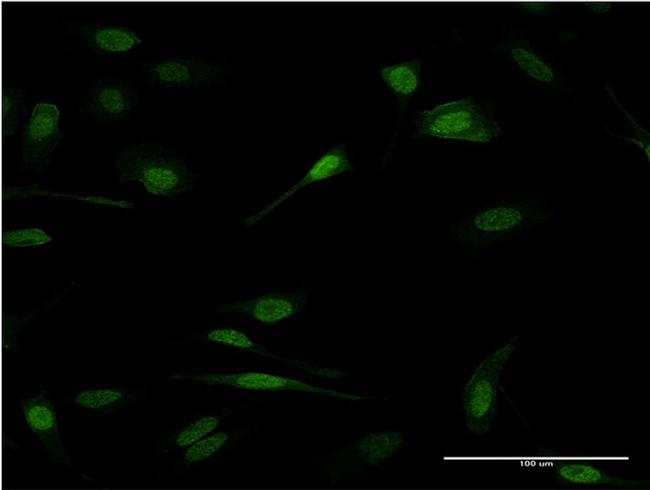 PRDM1 Antibody in Immunocytochemistry (ICC/IF)