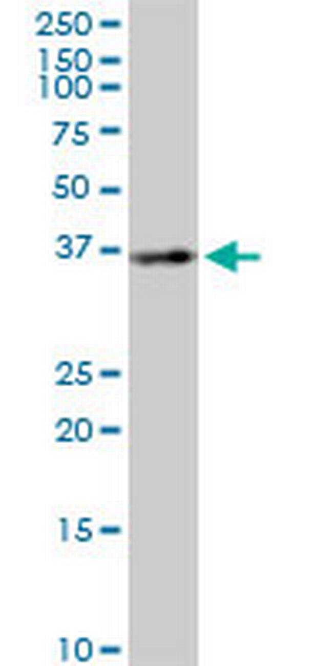 BLVRA Antibody in Western Blot (WB)