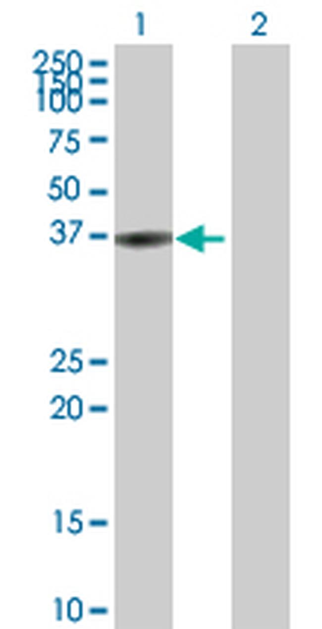 BLVRA Antibody in Western Blot (WB)