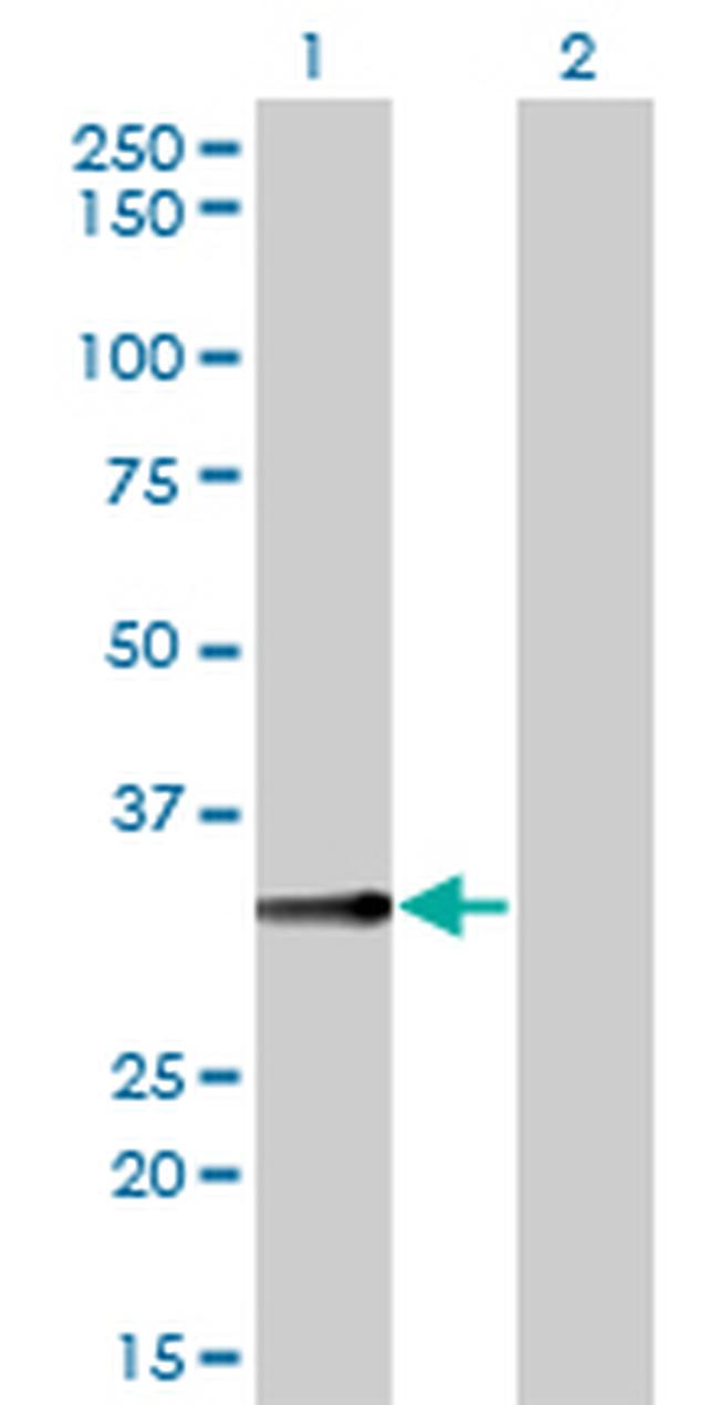 BLVRA Antibody in Western Blot (WB)