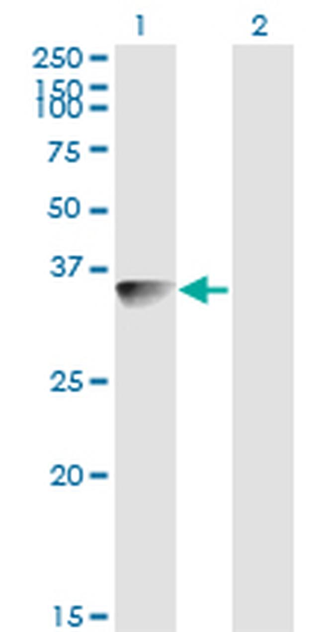 BLVRA Antibody in Western Blot (WB)