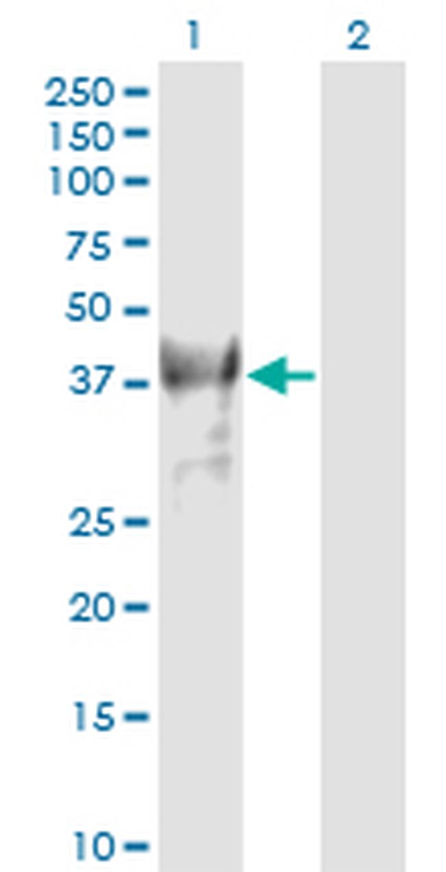 PCGF4 Antibody in Western Blot (WB)