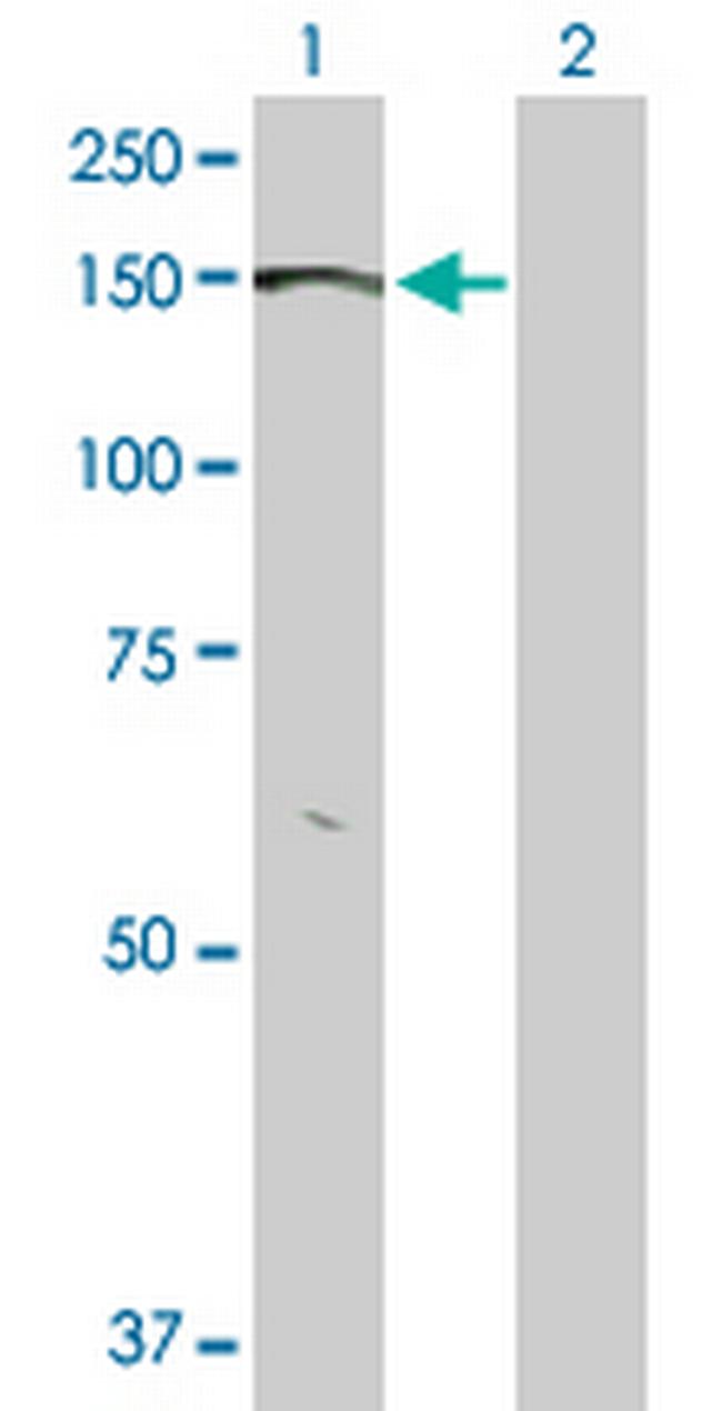 BMPR2 Antibody in Western Blot (WB)