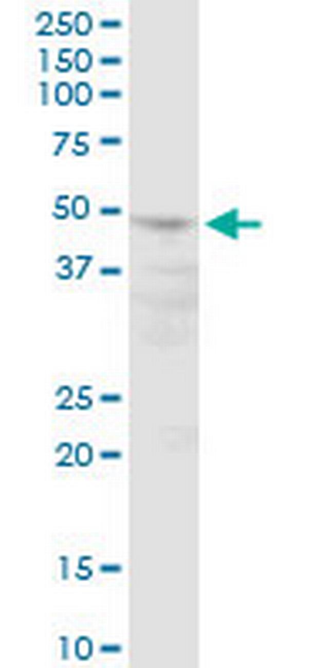 POLR3D Antibody in Western Blot (WB)