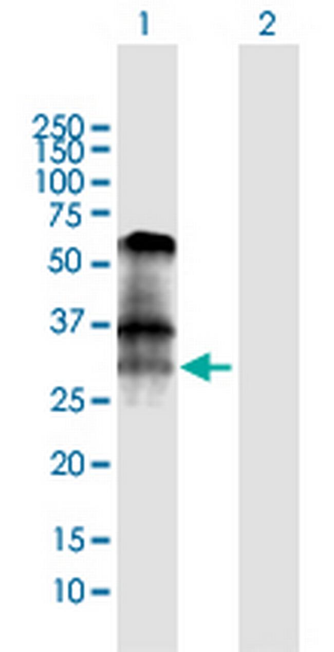 BNIP3 Antibody in Western Blot (WB)