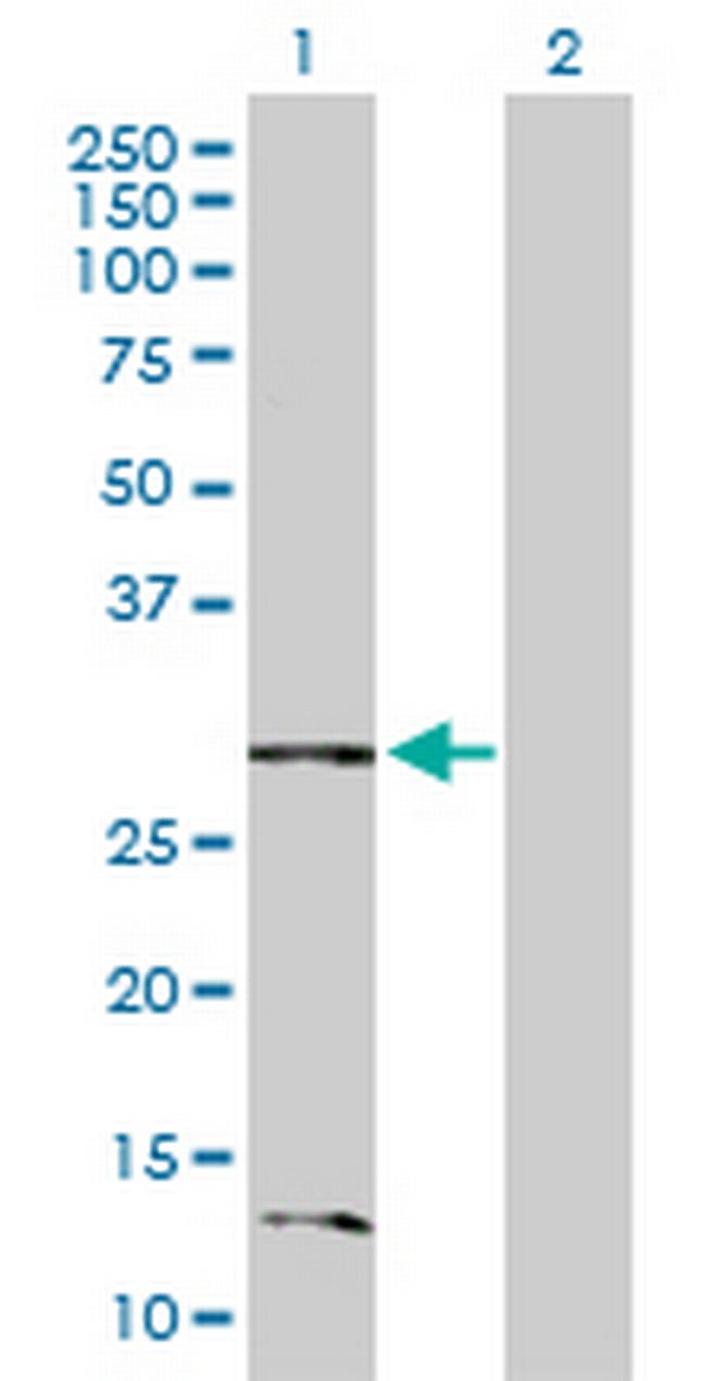 BNIP3L Antibody in Western Blot (WB)