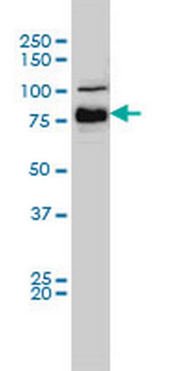 BRAF Antibody in Western Blot (WB)