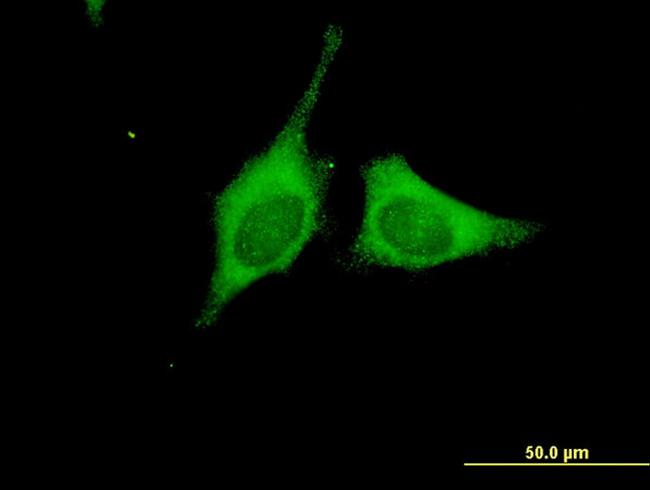 BRAF Antibody in Immunocytochemistry (ICC/IF)