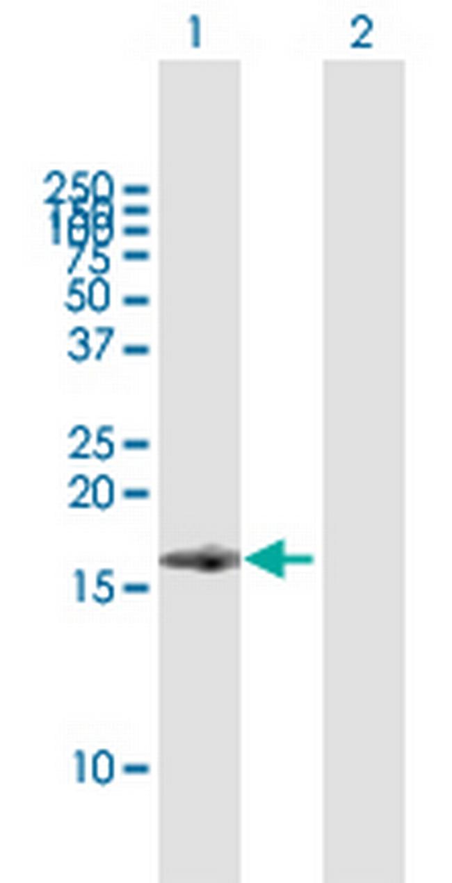 BST2 Antibody in Western Blot (WB)