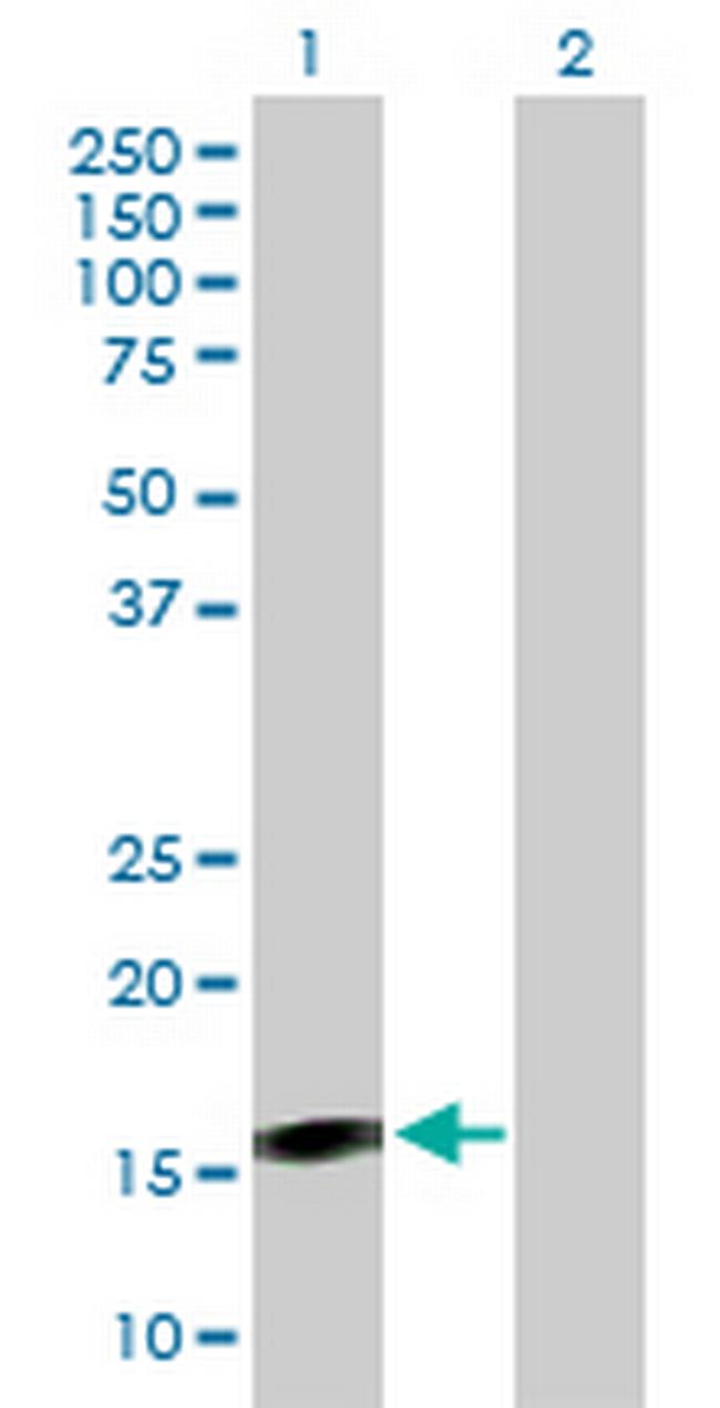 BST2 Antibody in Western Blot (WB)