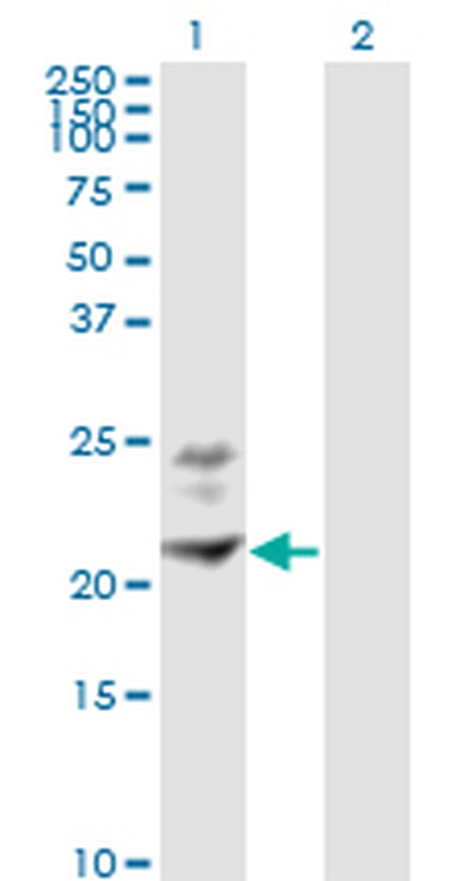 BST2 Antibody in Western Blot (WB)