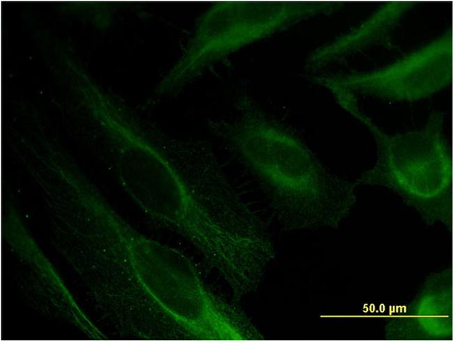 BST2 Antibody in Immunocytochemistry (ICC/IF)