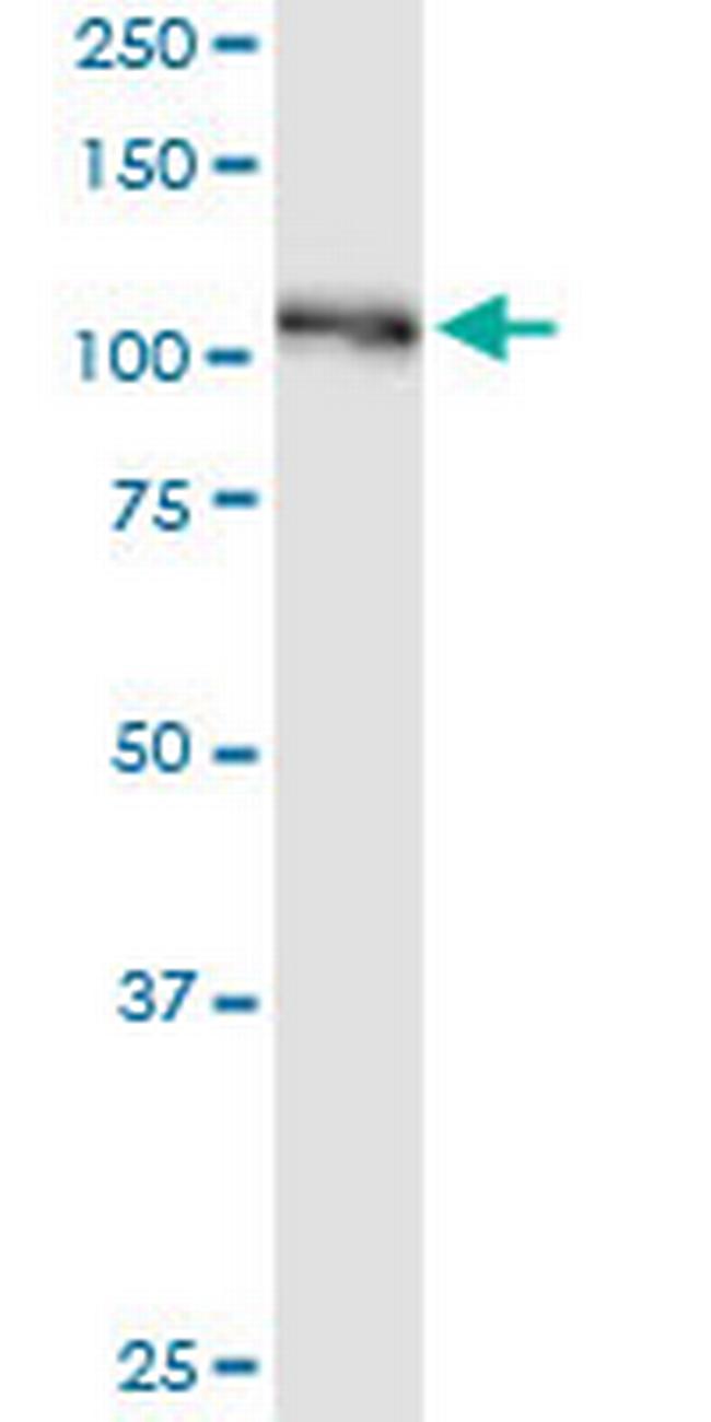 BUB1B Antibody in Western Blot (WB)