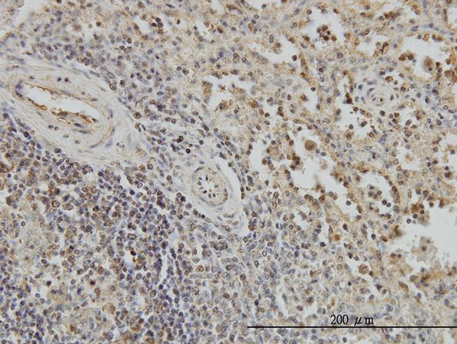 BUB1B Antibody in Immunohistochemistry (Paraffin) (IHC (P))