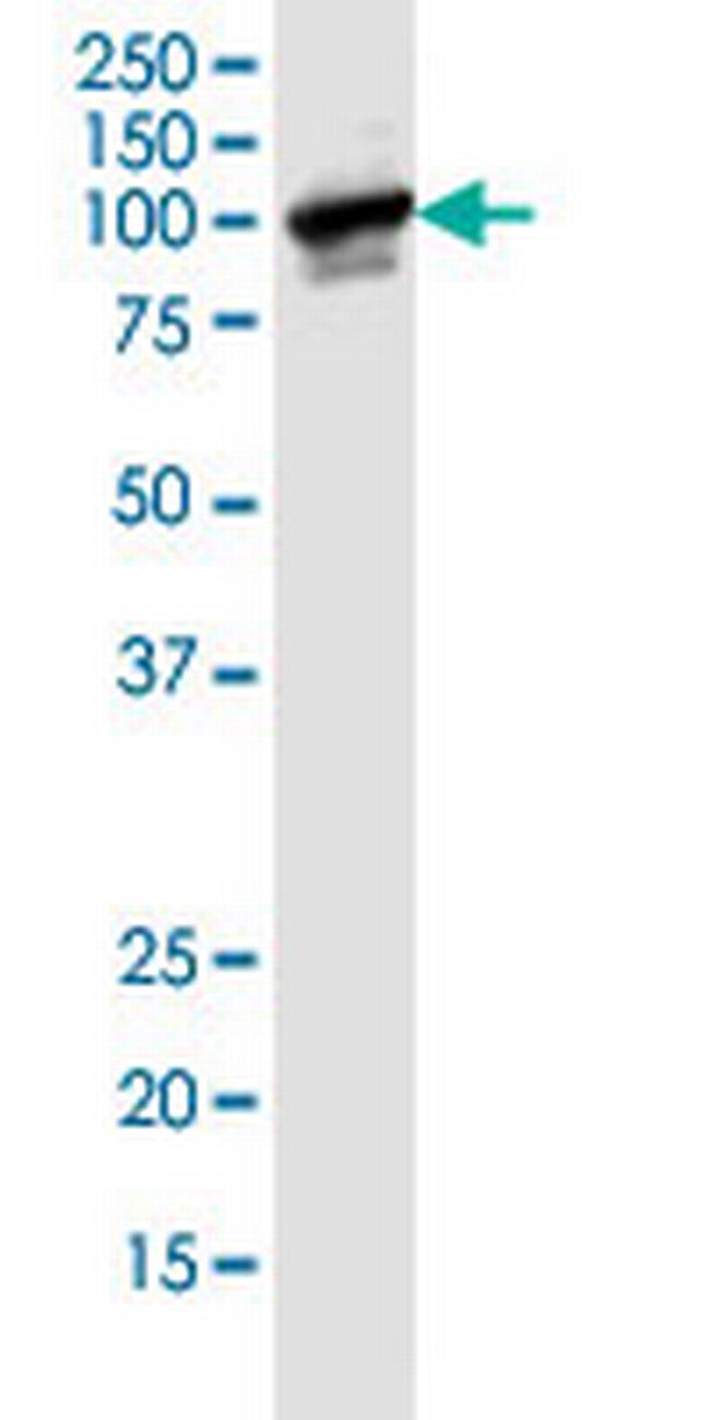 BUB1B Antibody in Western Blot (WB)