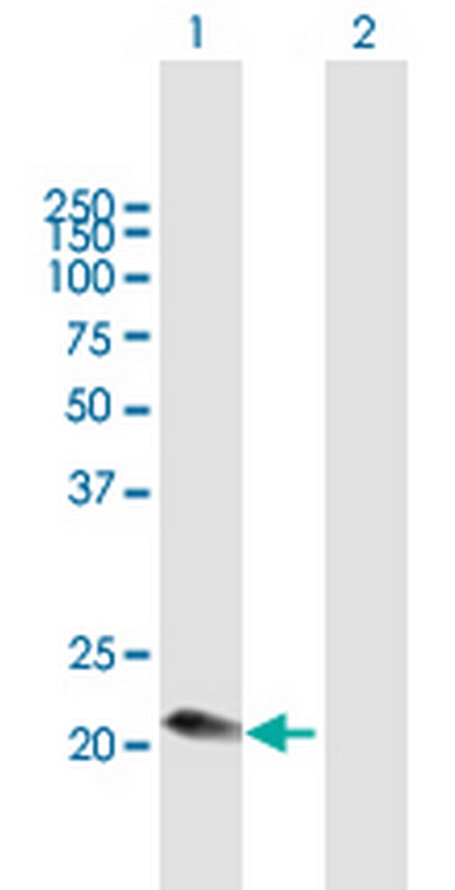 C1QC Antibody in Western Blot (WB)