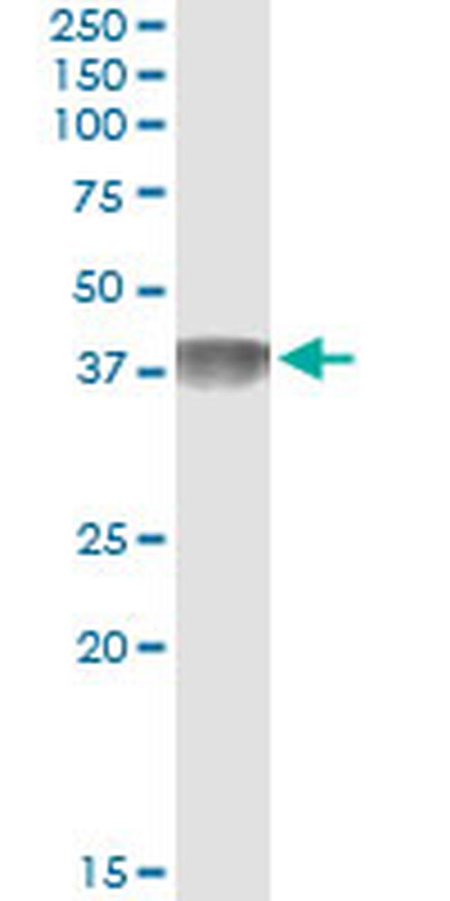 C4BPB Antibody in Immunoprecipitation (IP)