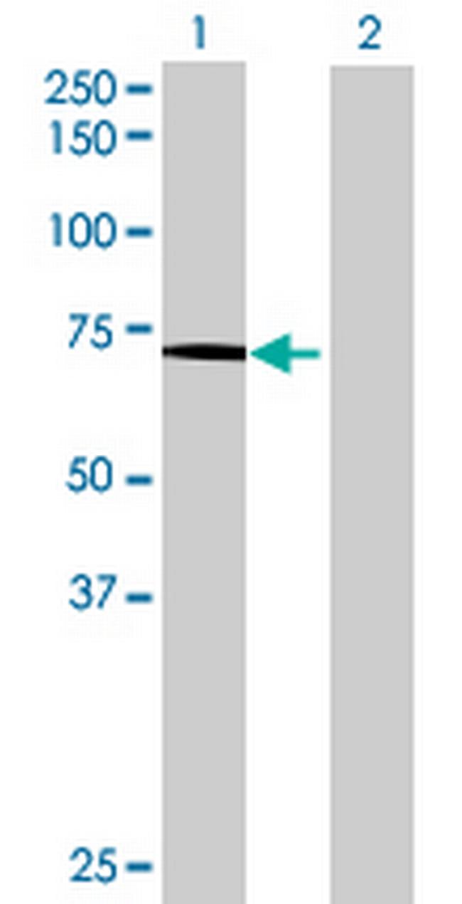 CAPN5 Antibody in Western Blot (WB)