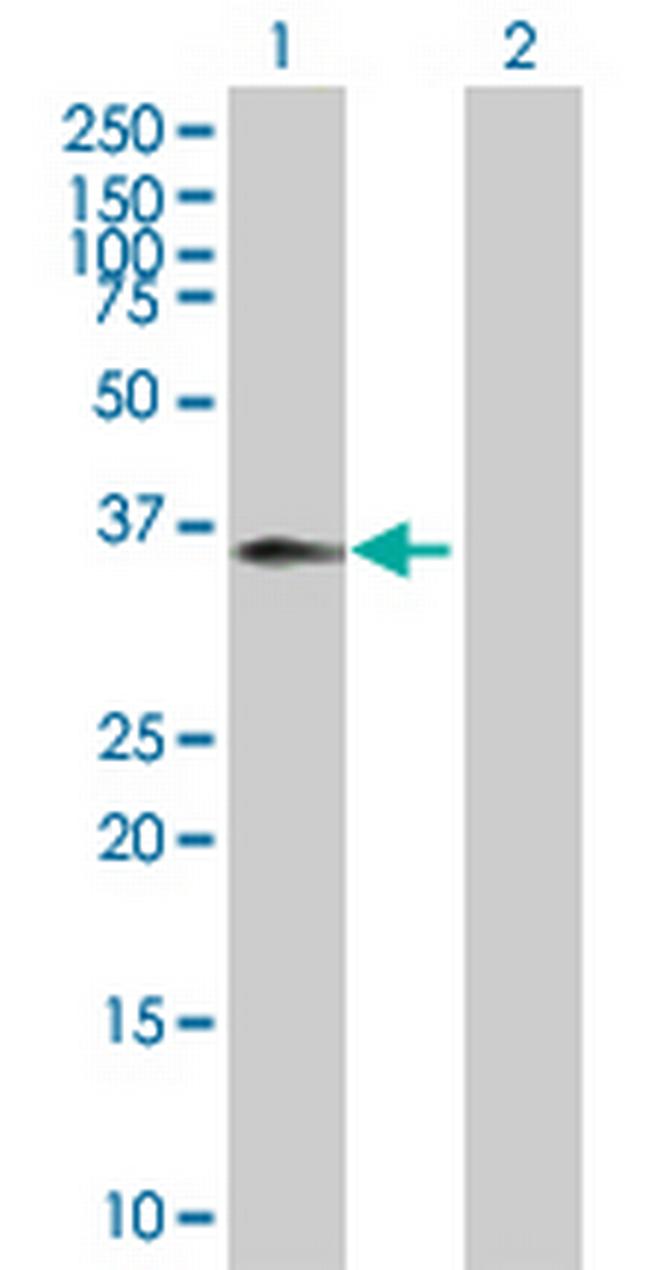 C5R1 Antibody in Western Blot (WB)