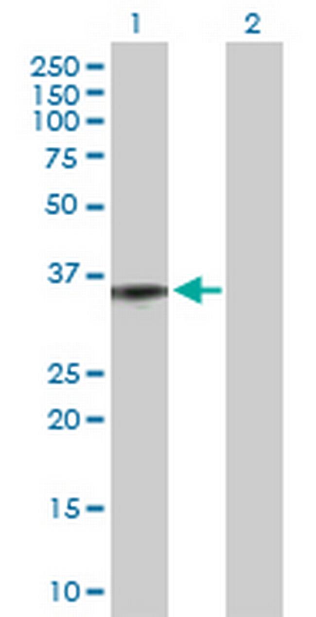 C5AR1 Antibody in Western Blot (WB)