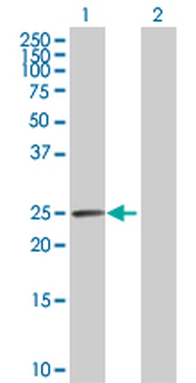 CA1 Antibody in Western Blot (WB)