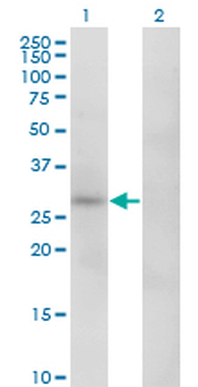 CA1 Antibody in Western Blot (WB)