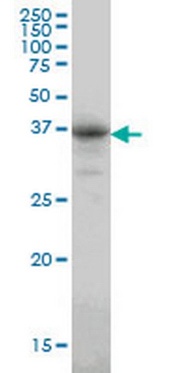 CA8 Antibody in Western Blot (WB)