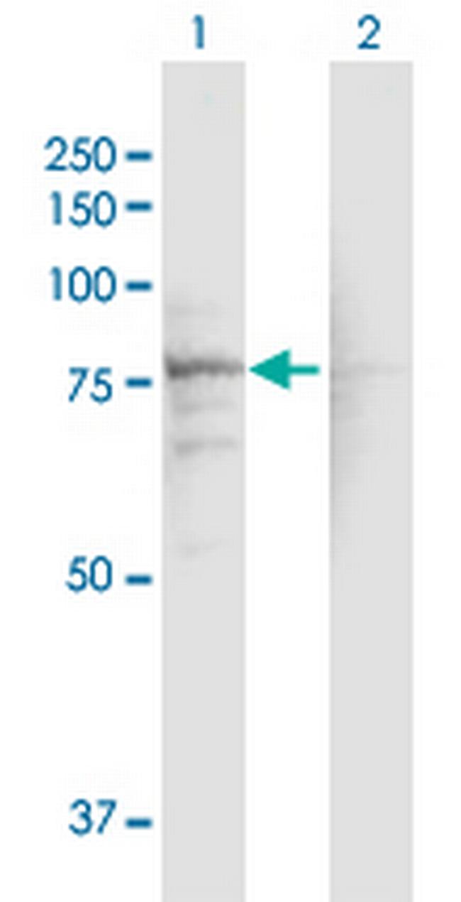 CACNB1 Antibody in Western Blot (WB)