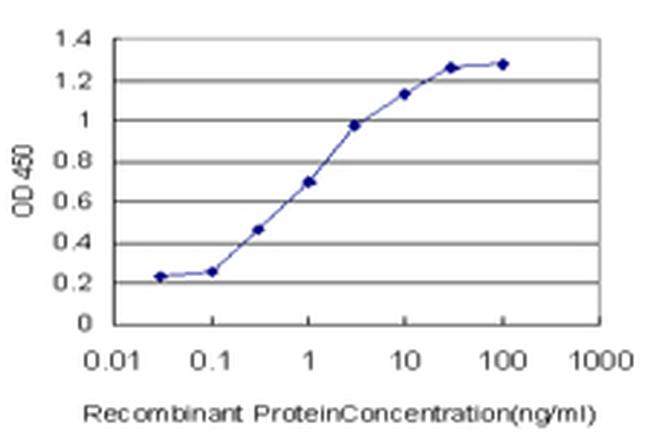 CACNB2 Antibody in ELISA (ELISA)