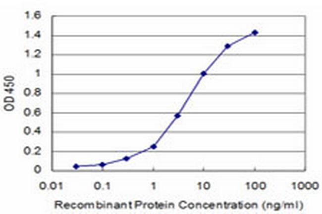 CACNB2 Antibody in ELISA (ELISA)