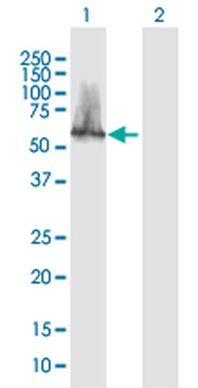 CACNB3 Antibody in Western Blot (WB)