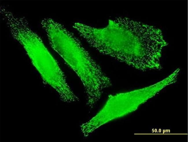 SLC25A20 Antibody in Immunocytochemistry (ICC/IF)