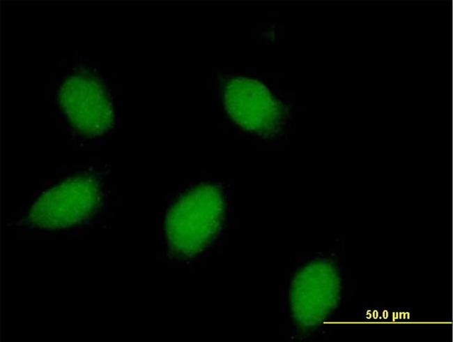 CALB1 Antibody in Immunocytochemistry (ICC/IF)