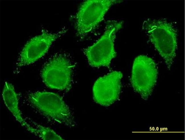 CALM2 Antibody in Immunocytochemistry (ICC/IF)