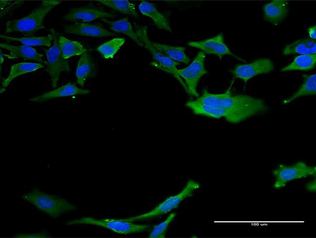 CALM3 Antibody in Immunocytochemistry (ICC/IF)