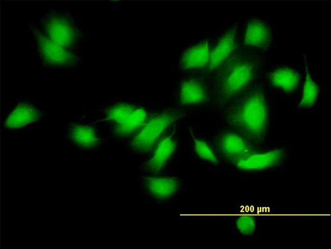 CAMK2A Antibody in Immunocytochemistry (ICC/IF)