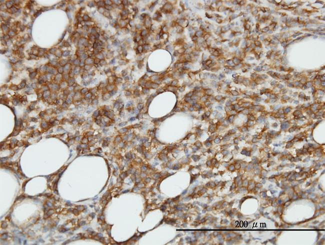 CAMK2B Antibody in Immunohistochemistry (Paraffin) (IHC (P))