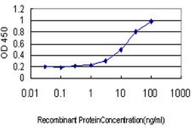 CAMK2B Antibody in ELISA (ELISA)